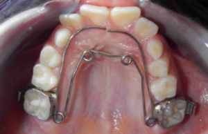 Ortho1