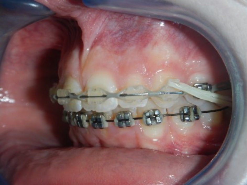 Ortho15