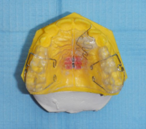 Ortho2