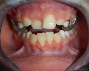 Ortho3