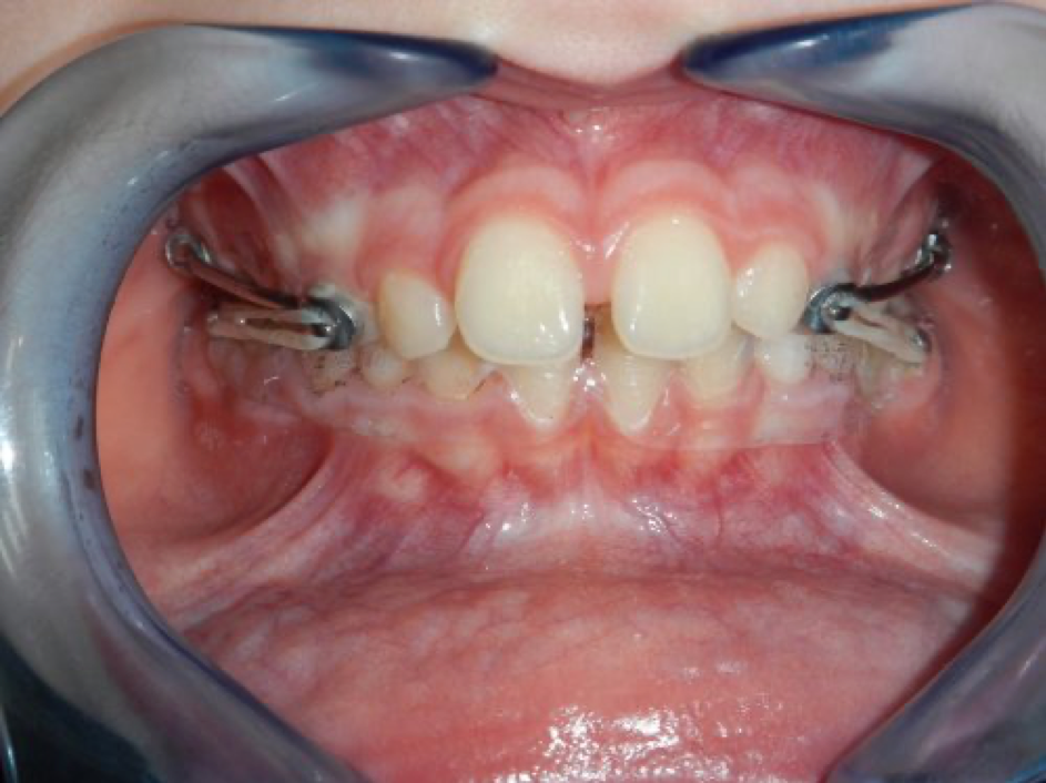 Ortho8